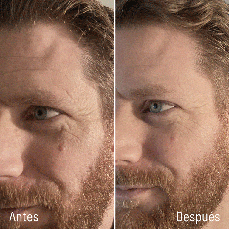 Carrusel de fotos de antes y después